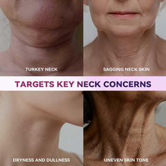 GOOSURE hyaluronic-acid skin-plump demonstrates hydration and crepe-resilience.