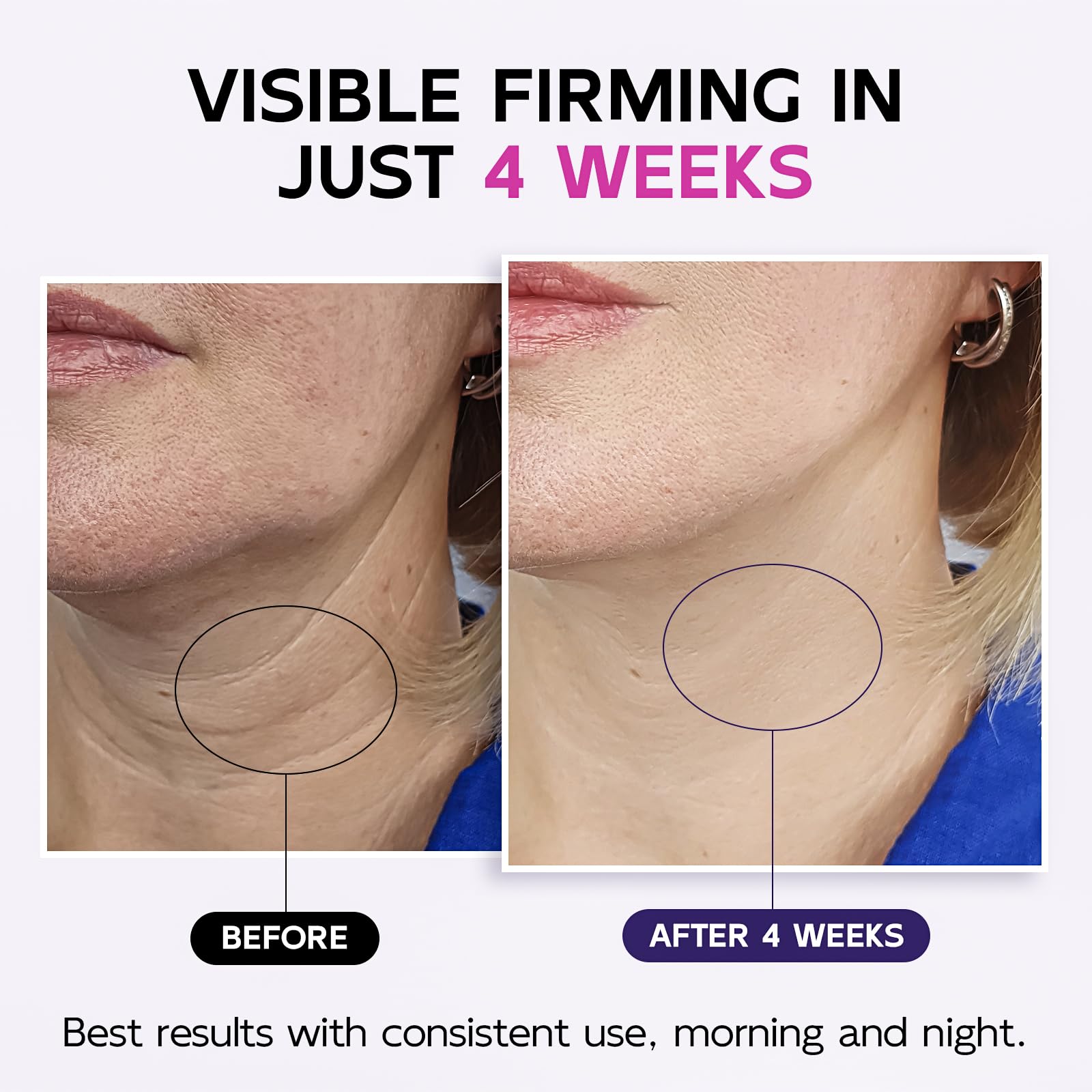 GOOSURE neck firming cream close-up highlights lifting potential and rich texture.