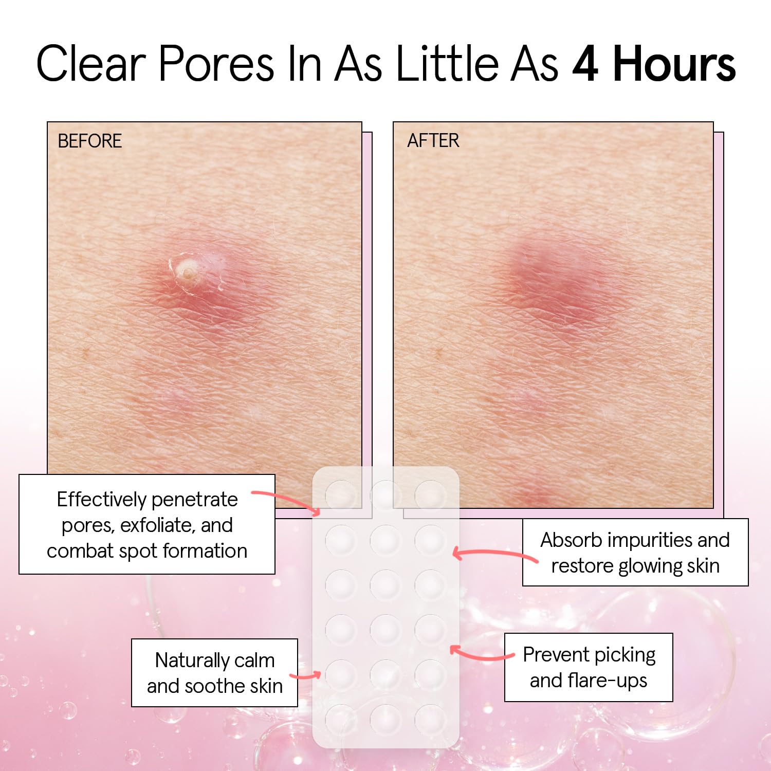 Grace & Stella patch application rapide, visage, utilisation simple et efficace.