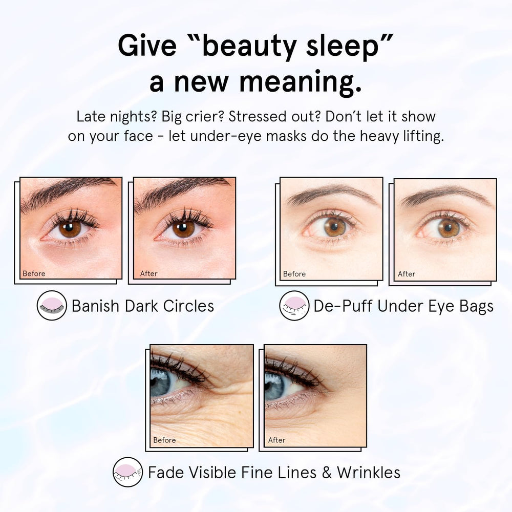 Grace & Stella masques-yeux-hyaluronique, hydratation douce et durable.