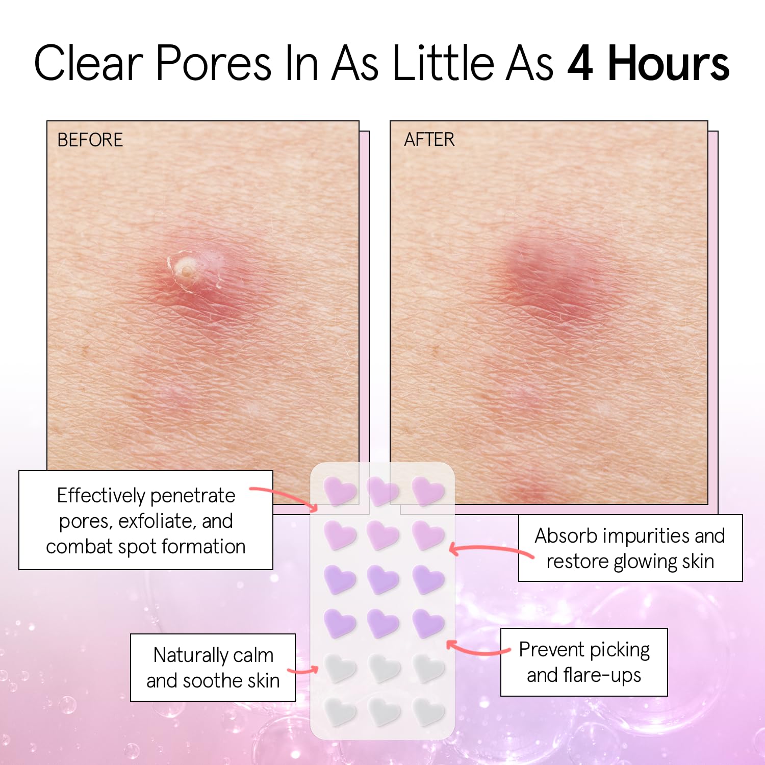 Pansement Grace & Stella coeurs colorés protègent contre les irritants extérieurs.