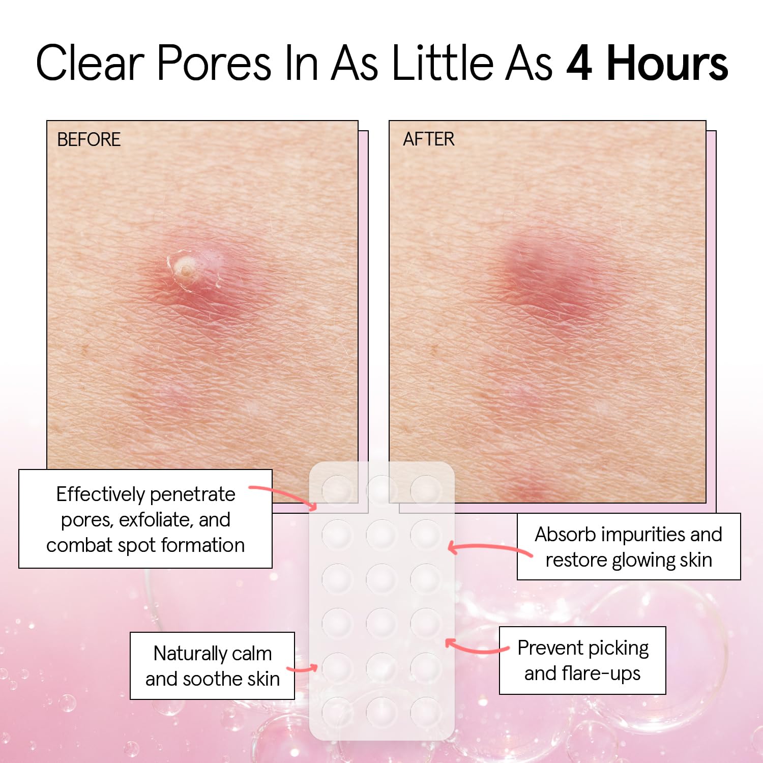 Emballage clair Grace & Stella patch hydrocolloïde, visuel épuré