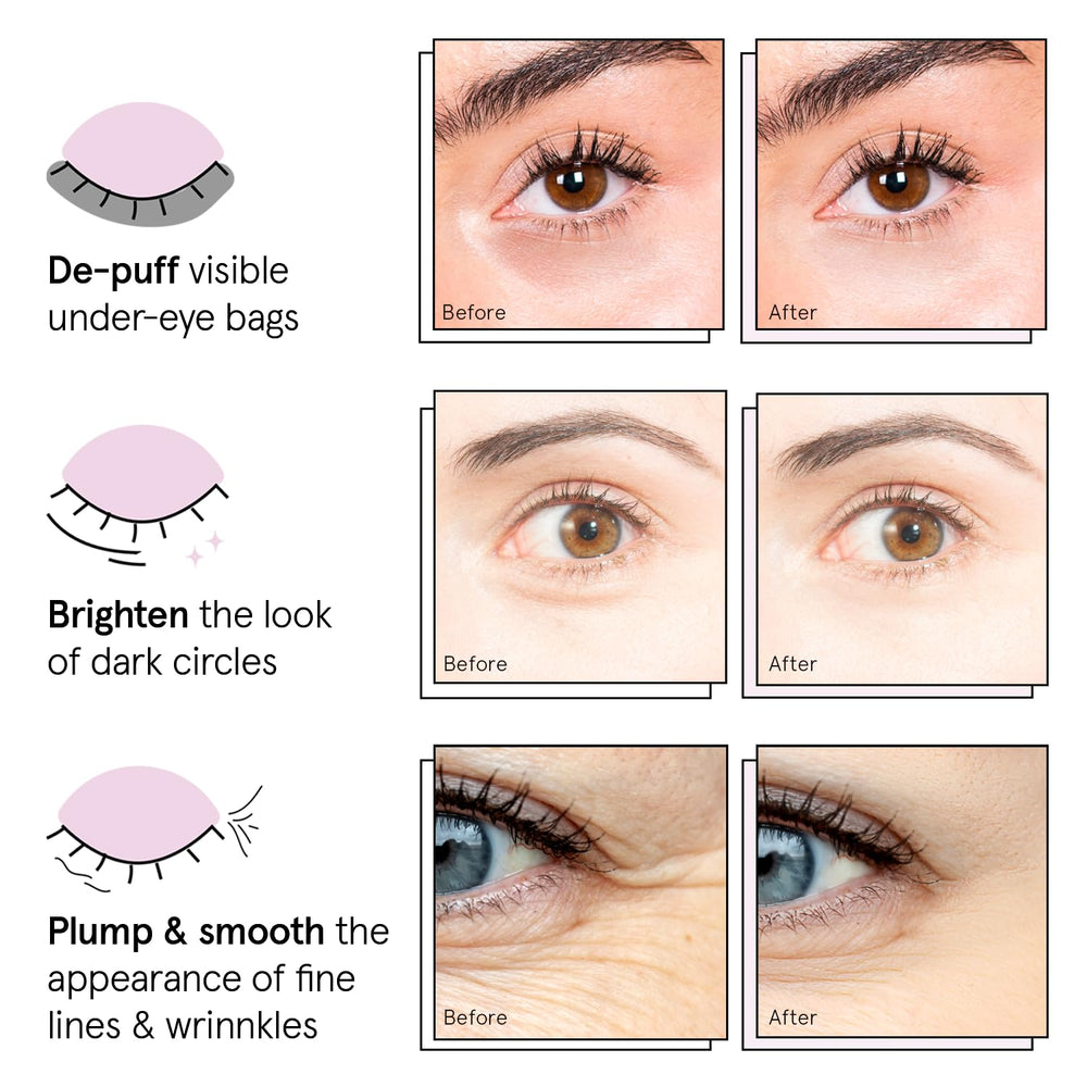Application des patchs Grace & Stella pour un regard plus frais après utilisation.