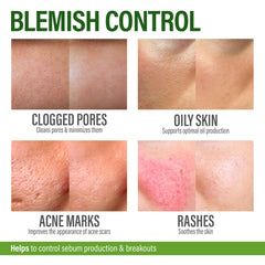 GRAMRIGHT Crème Acné dos torse, soin ciblé pour les zones sujettes.