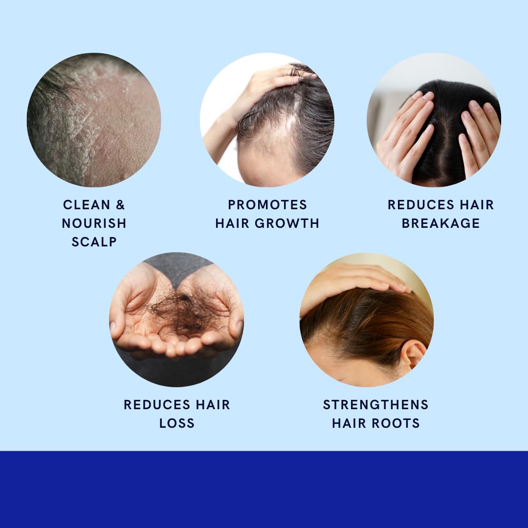 GREEN ROYALTY Minoxidil Shampoing – parfaite routine soin capillaire complète.