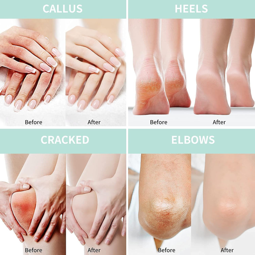 Grocerism Crème Urea 50% usage zones multiples: pieds, mains et coudes.
