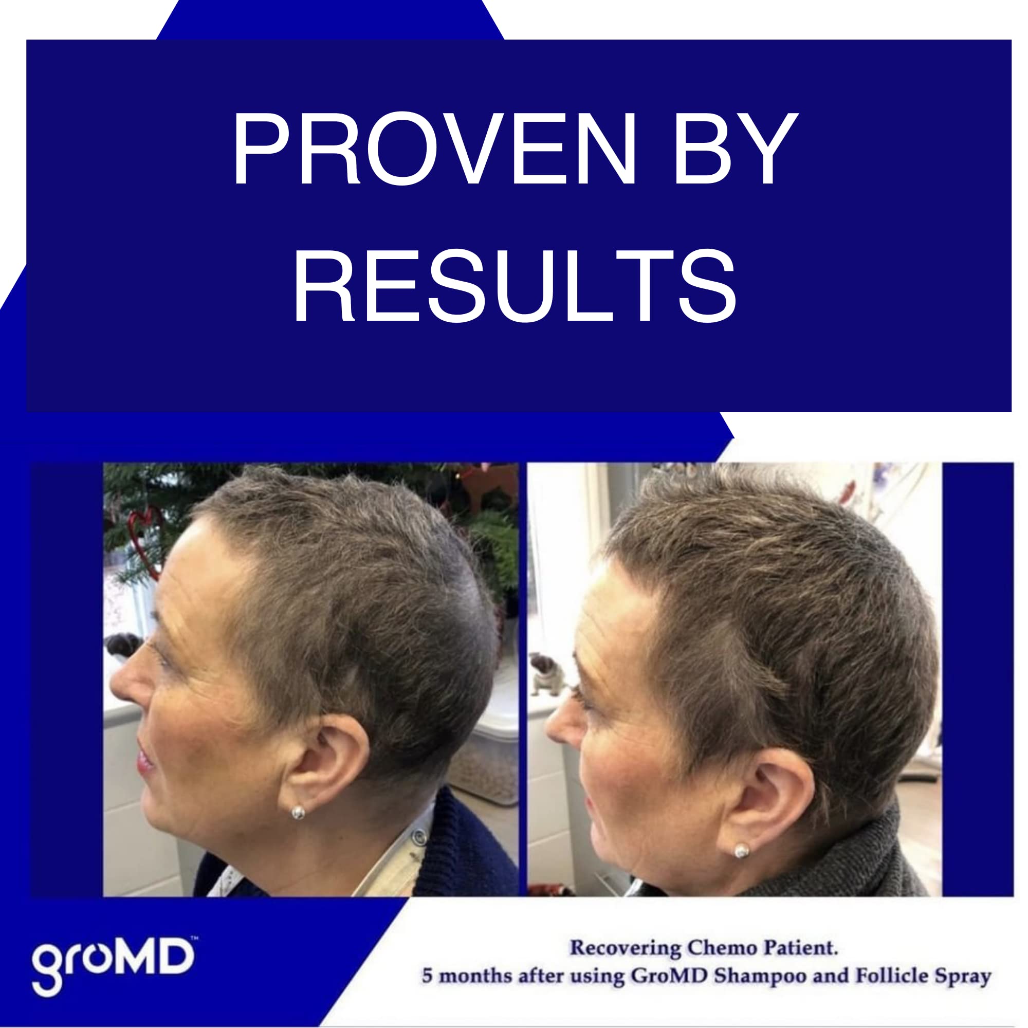 GroMD Huile d'Argan: soin capillaire nourrissant pour cheveux brillants.