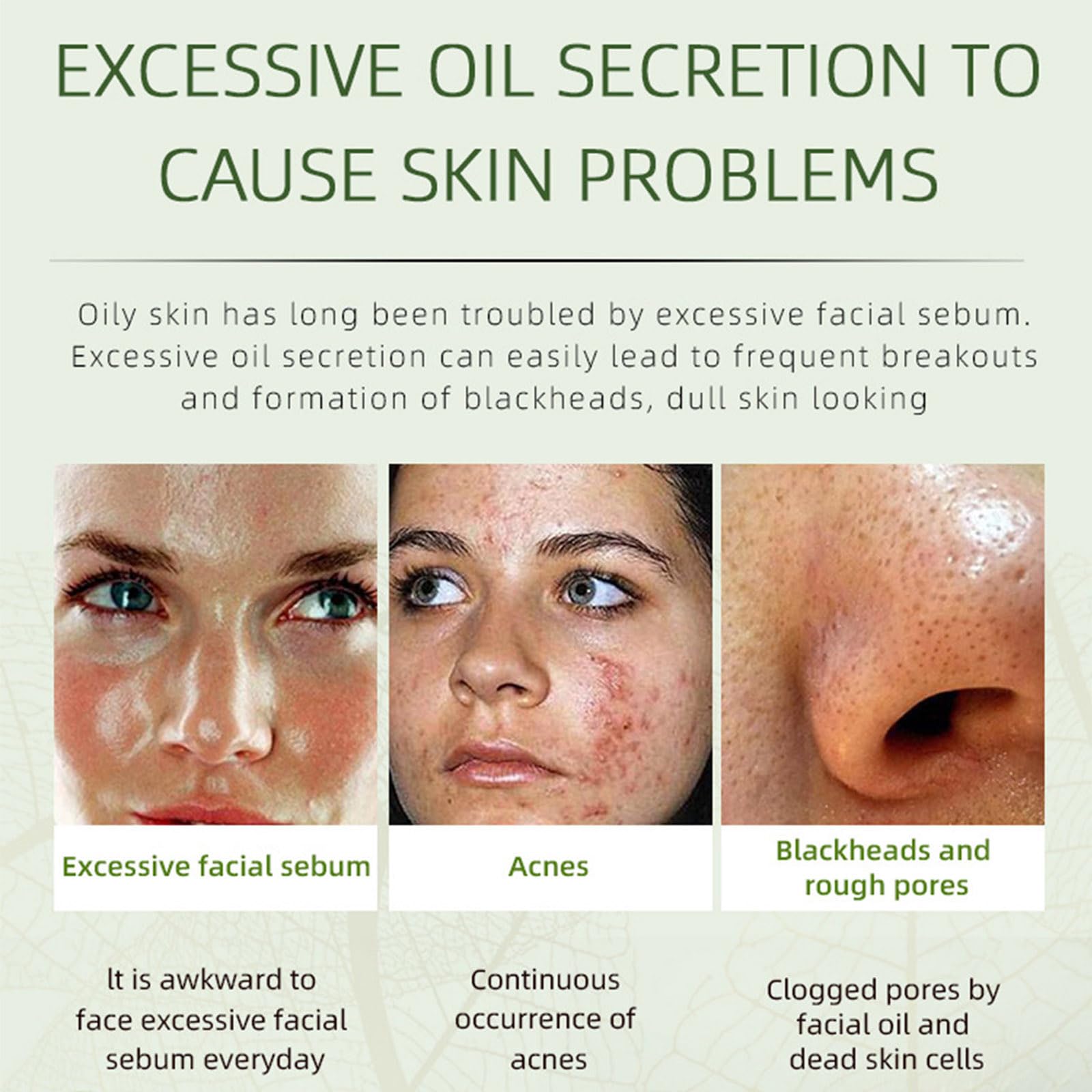 Grospe Crème Anti‑Acné texture onctueuse qui apaise la peau.