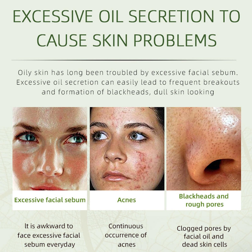 Grospe Crème Anti‑Acné texture onctueuse qui apaise la peau.