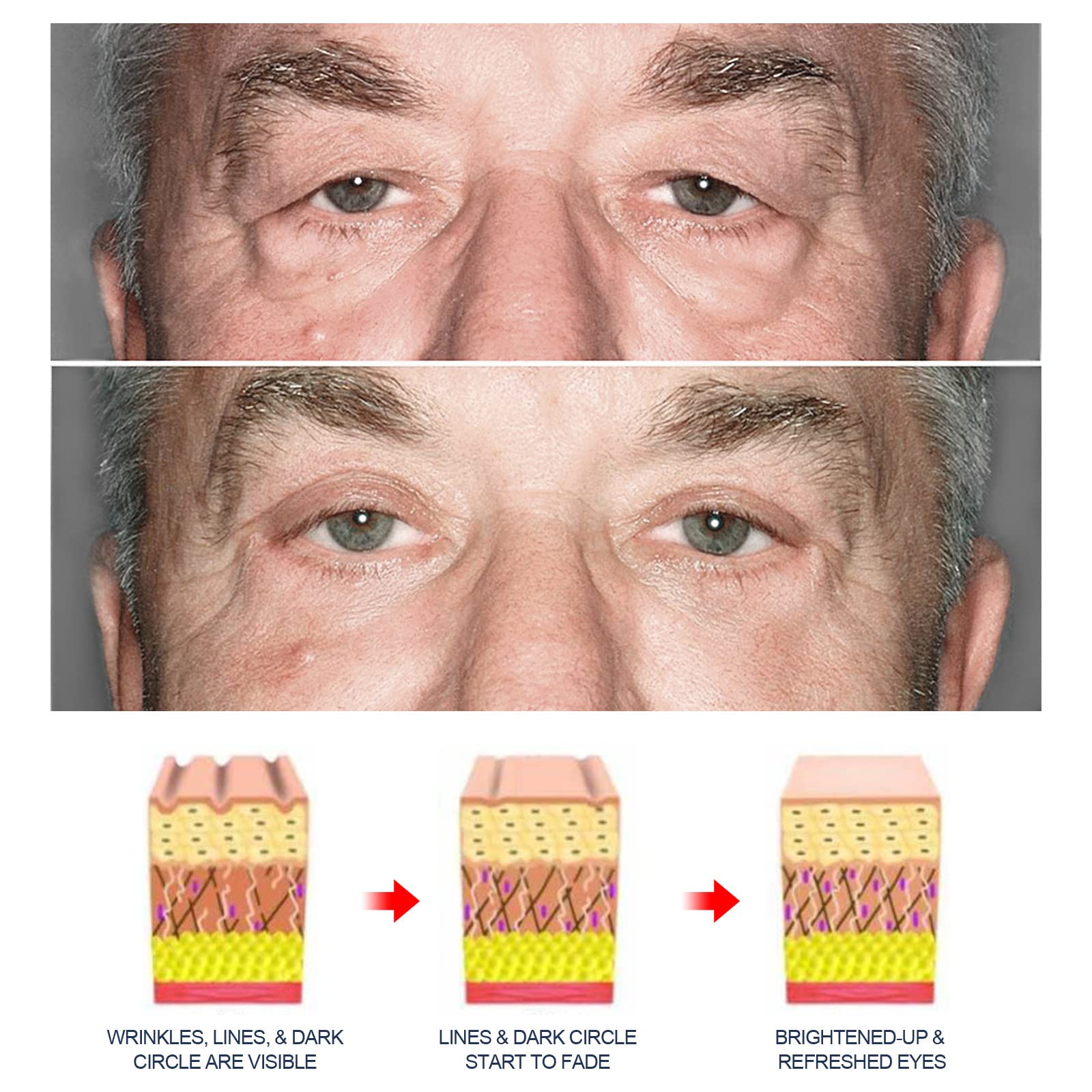 Grospe Gel Yeux Peptide — après application avec poches visiblement atténuées