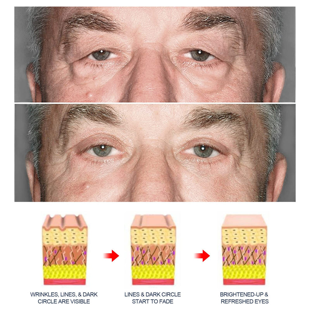 Grospe Gel Yeux Peptide — après application avec poches visiblement atténuées
