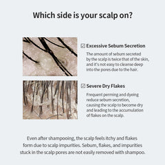 GROWUS acide salicylique offre une exfoliation légère du cuir chevelu.