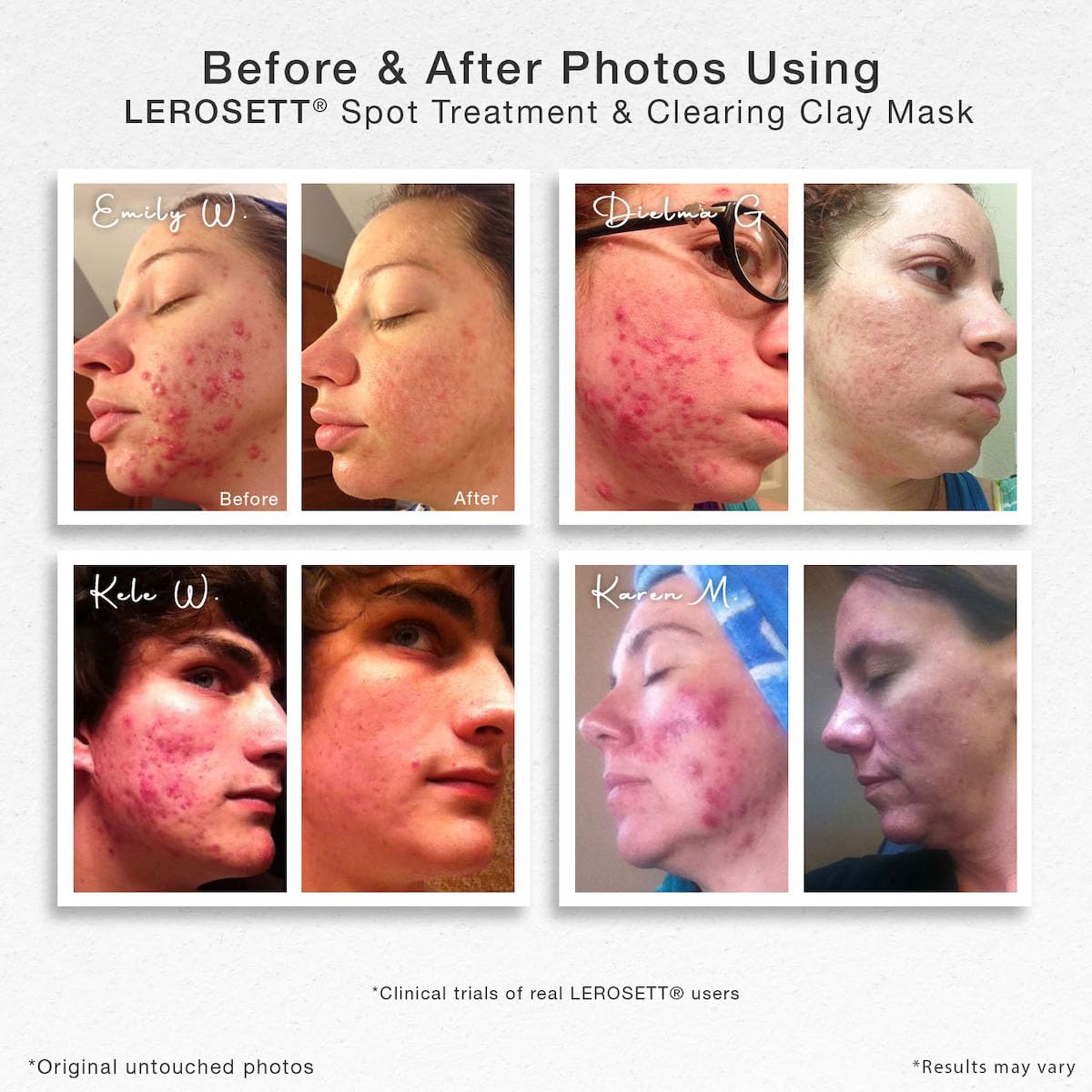 Texture crème LEROSETT facilitant une application douce et purifiante du visage