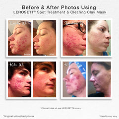 Texture crème LEROSETT facilitant une application douce et purifiante du visage