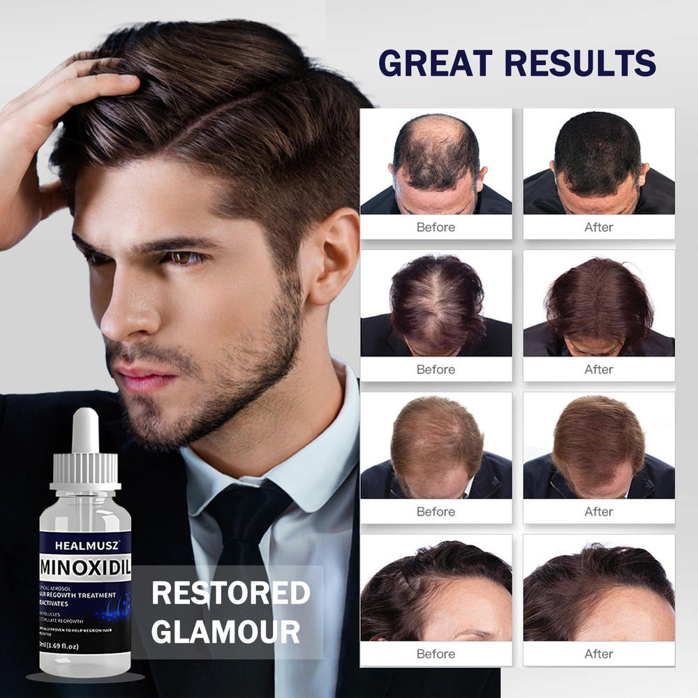 GXQ Minoxidil application mains pour soin capillaire.