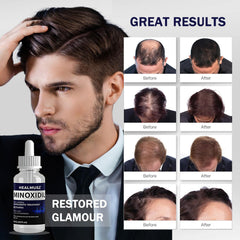 GXQ Minoxidil application mains pour soin capillaire.