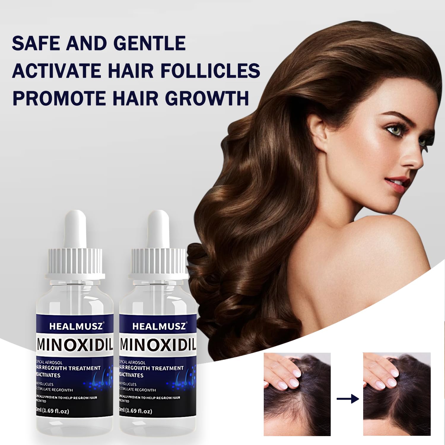 GXQ Minoxidil adapté hommes et femmes pour routine unisexe.