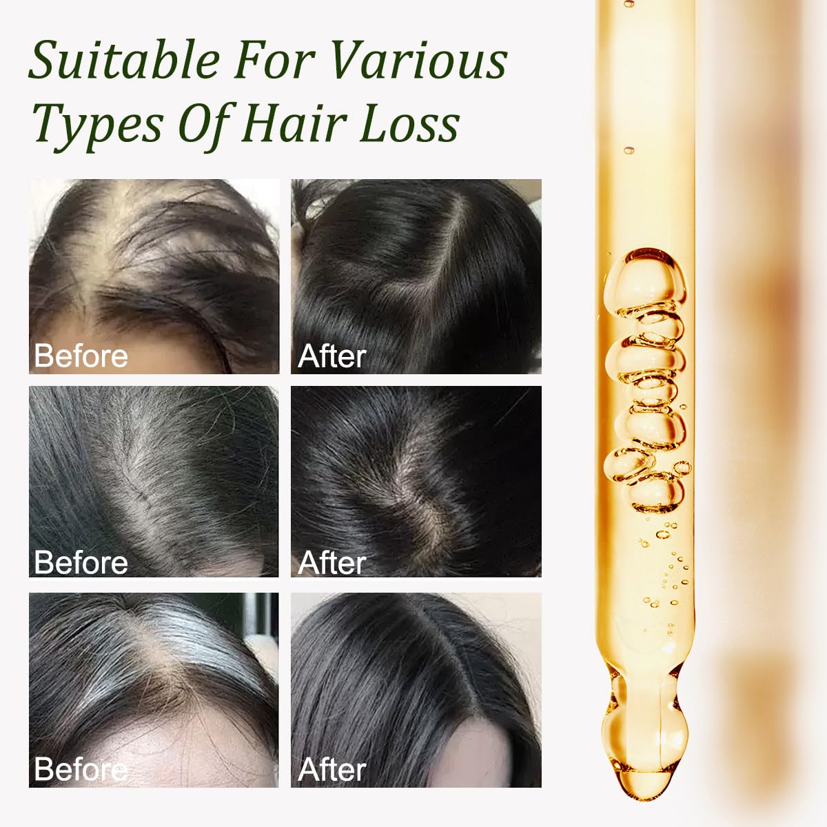 Gypsophila Batana Oil softens hair strands and reduces breakage