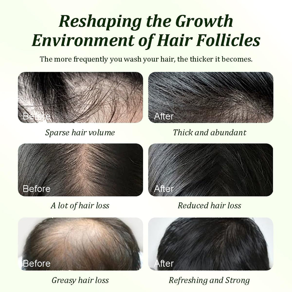 Formule sans sulfates pour un nettoyage respectueux des cheveux.