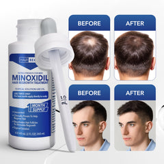 Hair Regen Minoxidil: usage quotidien au travail et en salle de sport, pratique et discret.
