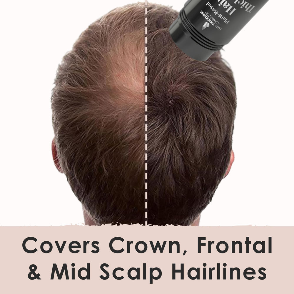Hair Thickness Maximizer fibers on crown shows natural-looking volume and coverage.