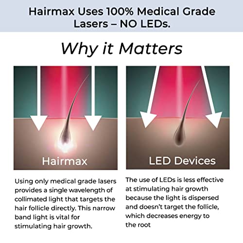 HairMax LaserBand 82 montre ses lasers médicaux pour une couverture efficace du cuir chevelu.