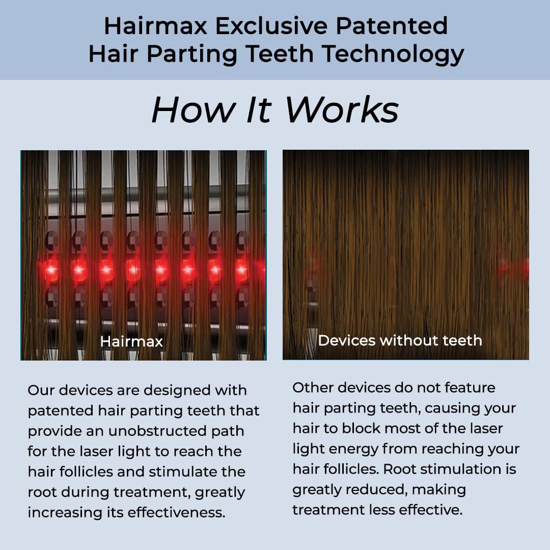 Hairmax Ultima9 Classic démonstration de lumière rouge pour cheveux.