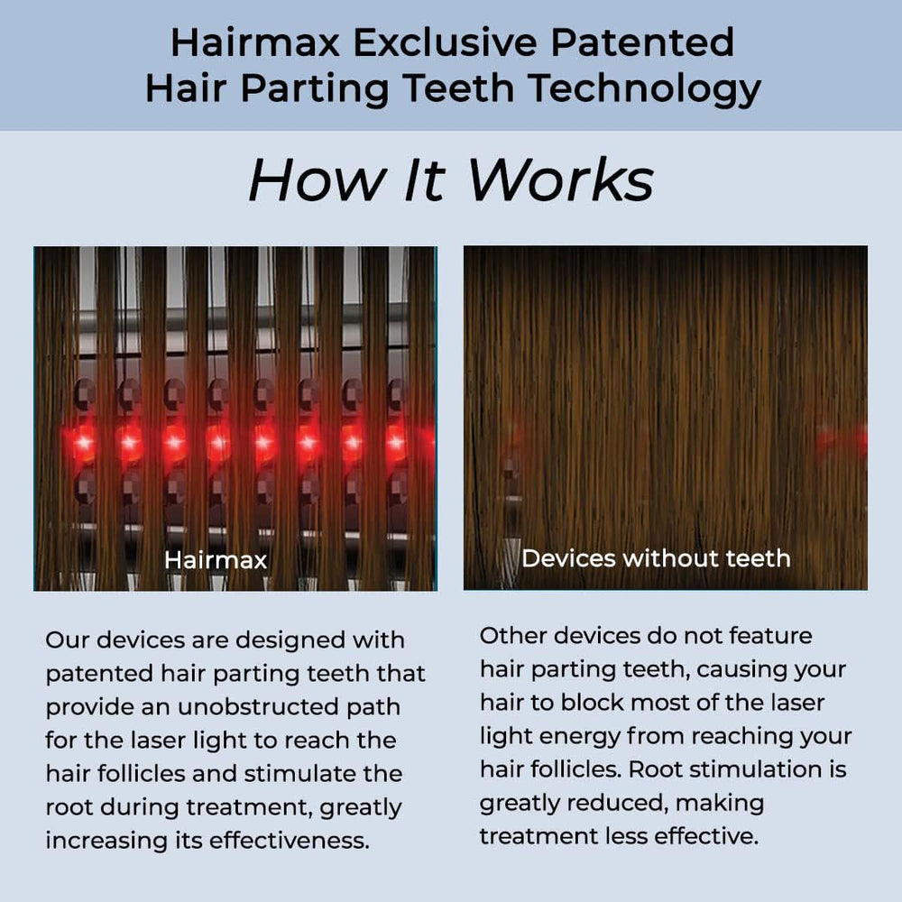 Hairmax Ultima9 Classic démonstration de lumière rouge pour cheveux.