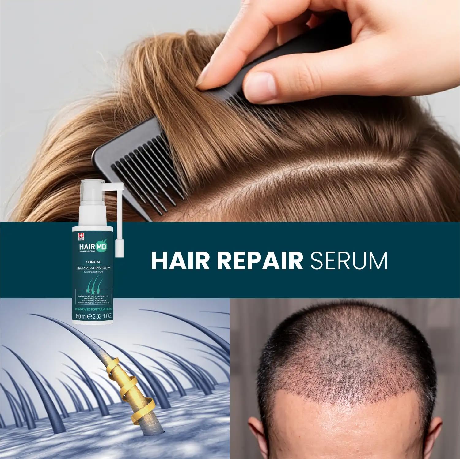 Soin post-transplant HairMD pour cuir chevelu doux et sain