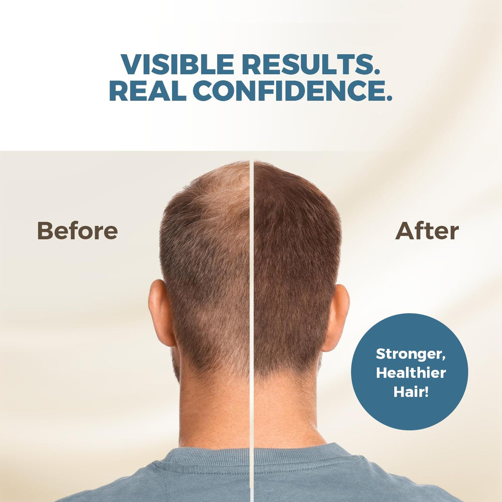 HAIRMETTO sérum stimulation des follicules pour cheveux plus épais.