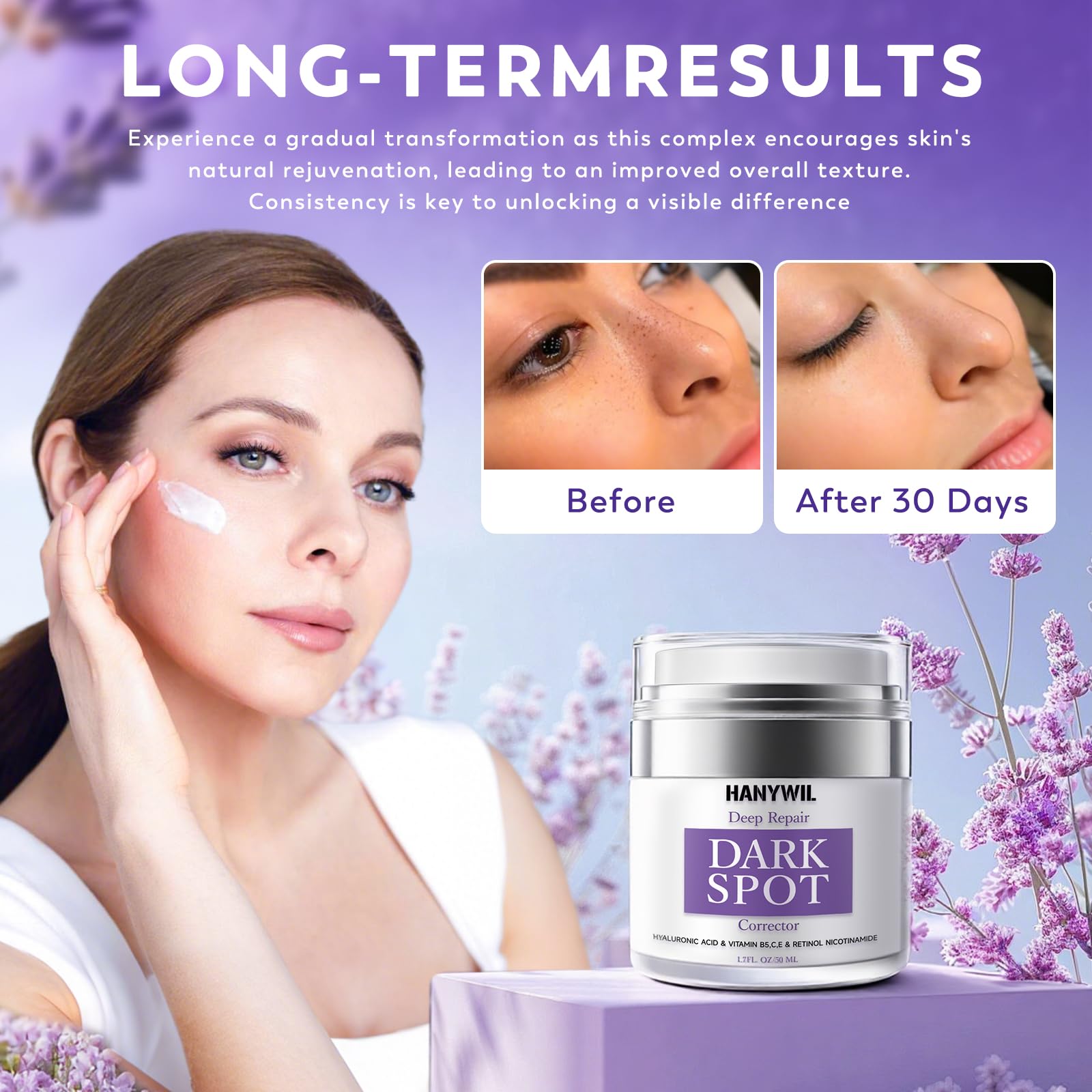 Crème correctrice HANYWIL pour taches visage, teint plus uniforme.