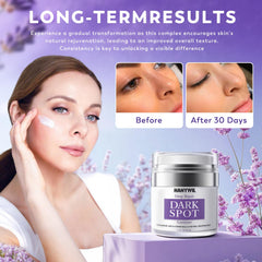 Crème correctrice HANYWIL pour taches visage, teint plus uniforme.