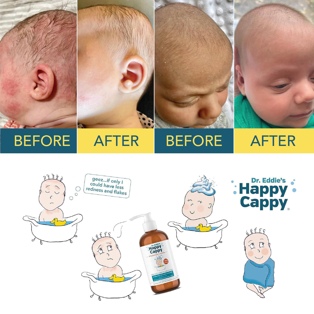 Étiquette du shampoing Happy Cappy testée dermatologiquement sans parfum pour bébés.