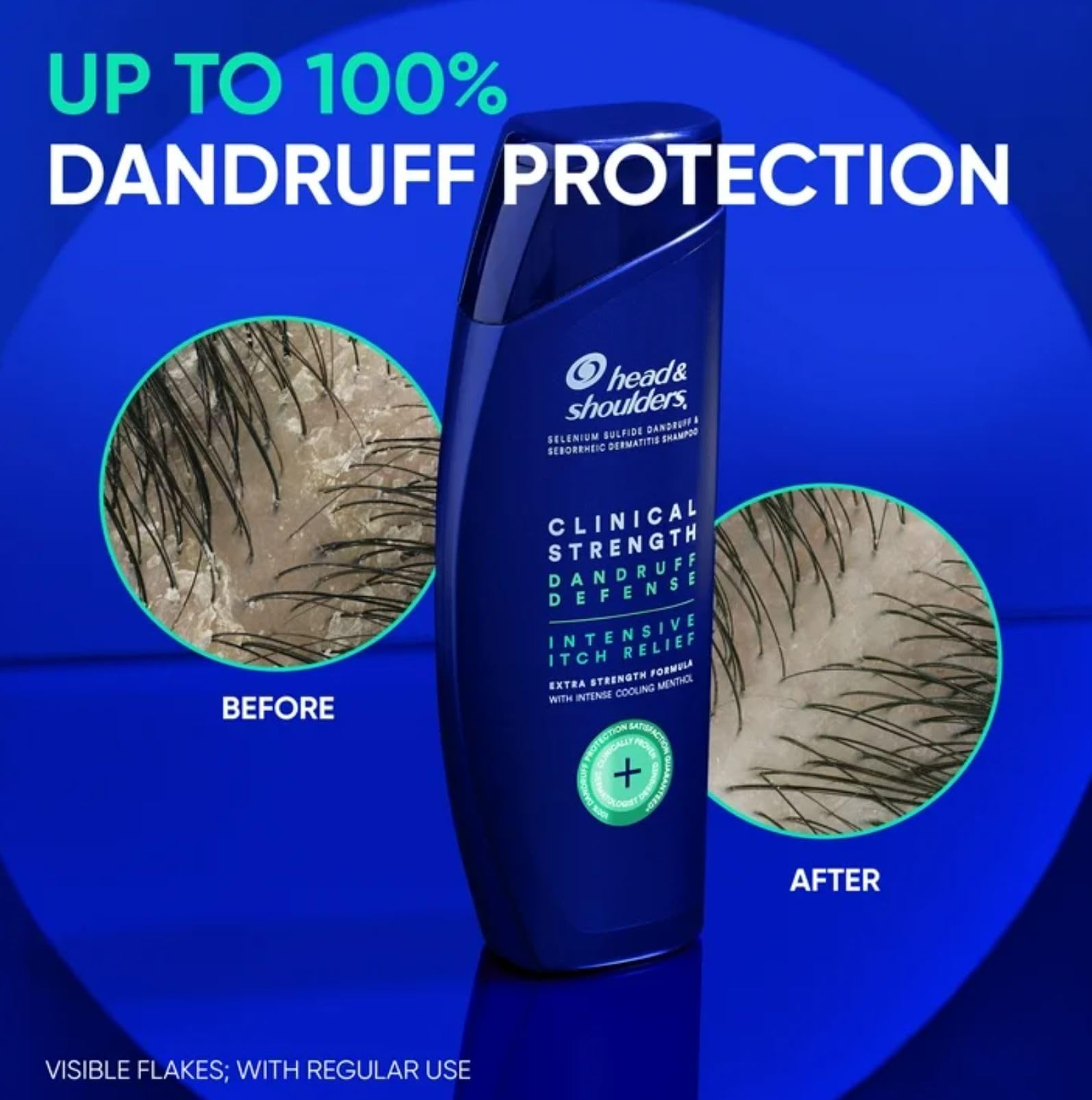 Head & Shoulders Clinical Strength - pack de deux bouteilles pour une utilisation continue.