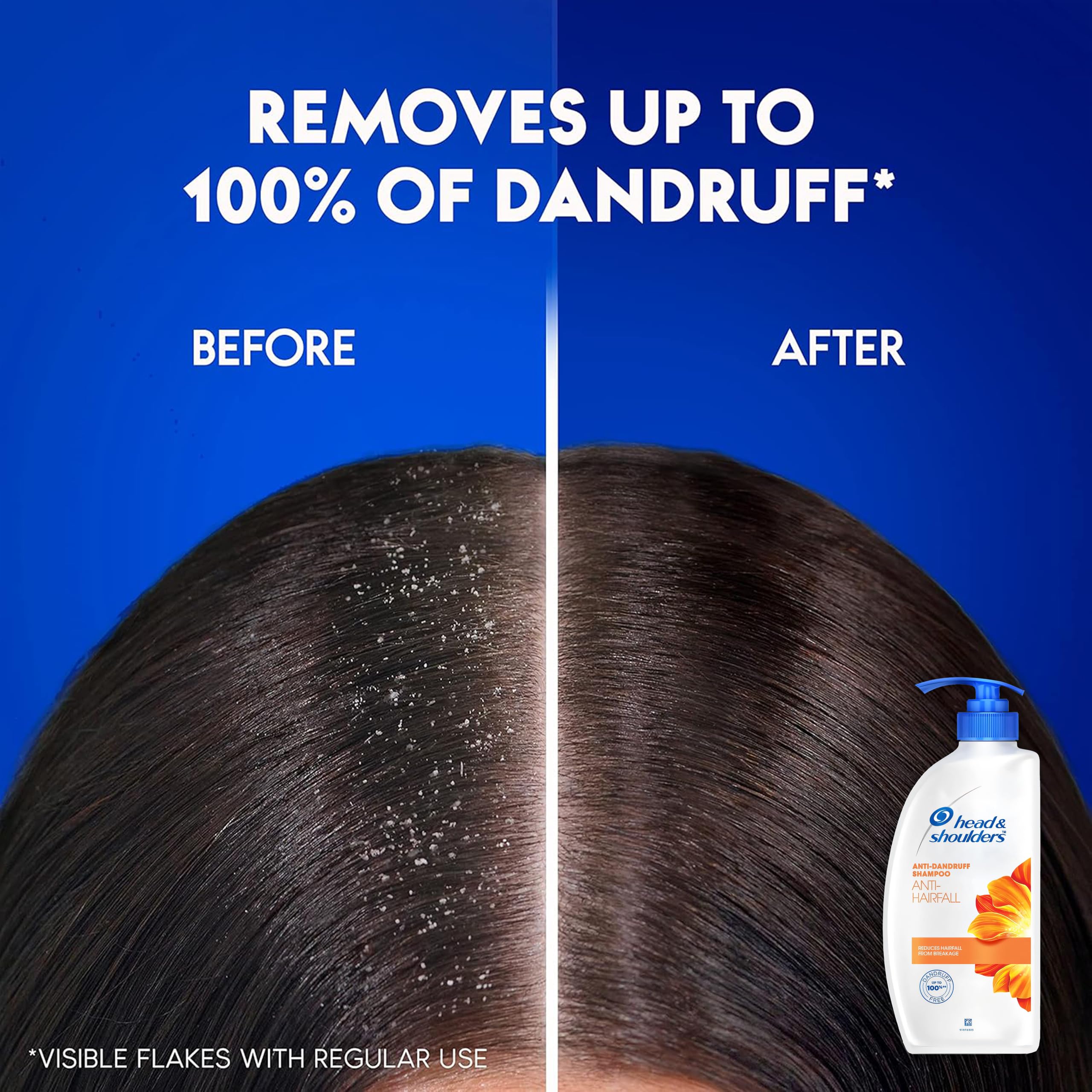 Head & Shoulders – étiquette claire et flacon pratique pour l’utilisation