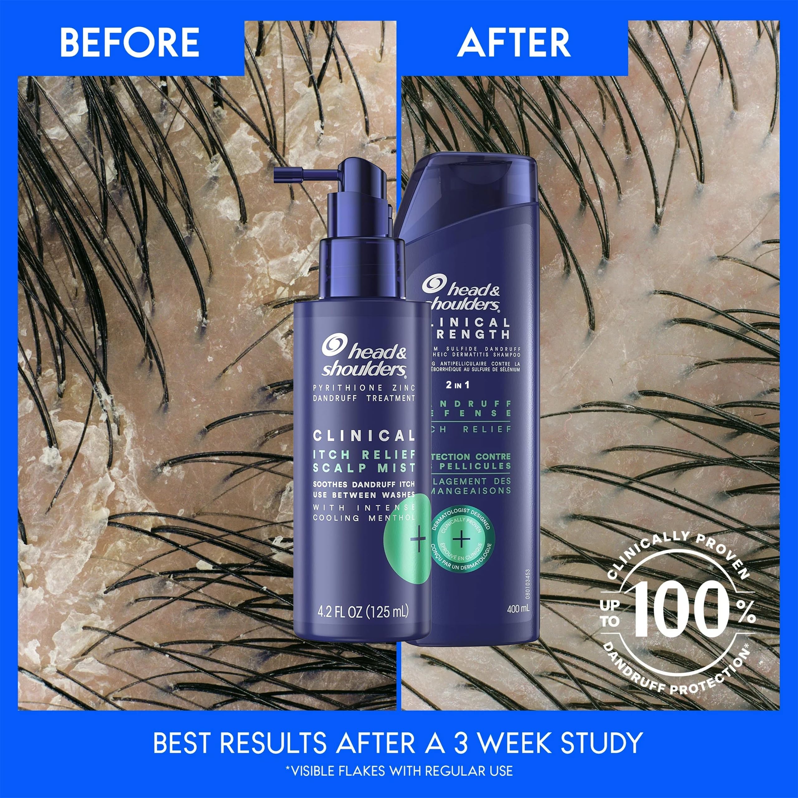 Moment de soin quotidien Head & Shoulders pour cheveux propres