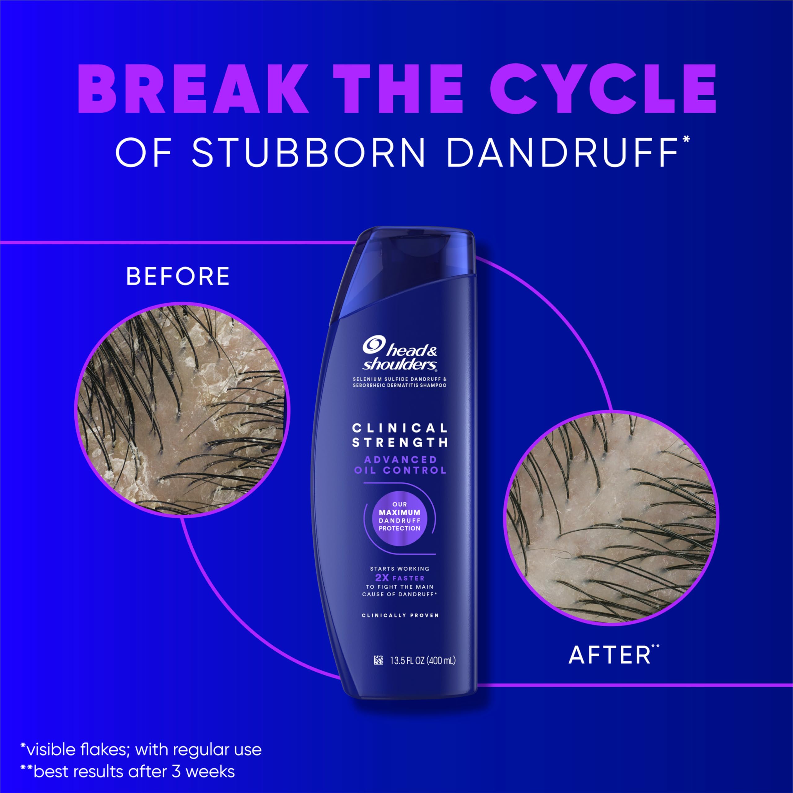 Utilisation régulière Head & Shoulders pour pellicules visibles réduites.