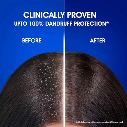 Convient aux cheveux colorés ou traités chimiquement Head & Shoulders.