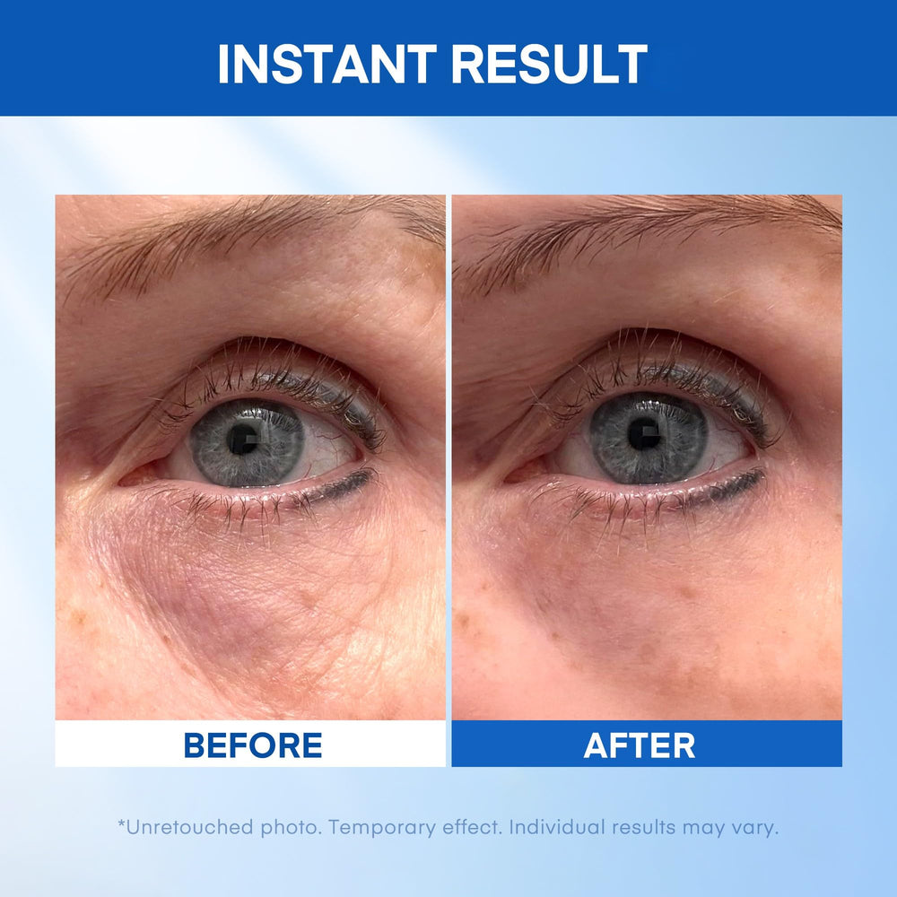 HealthyDerm Sérum Lift Regard – Application rapide pour un regard frais