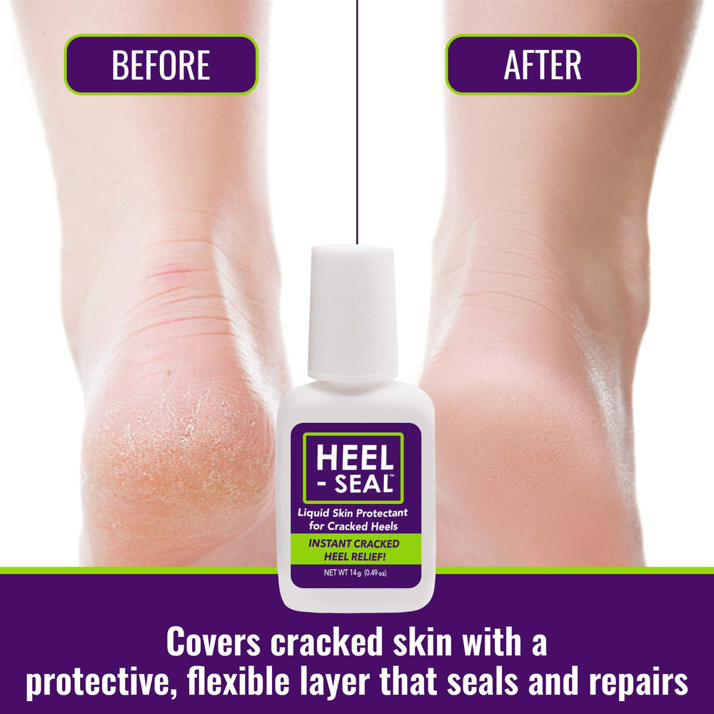 Heel-Seal tampon-preparation pour enlever les peaux mortes.