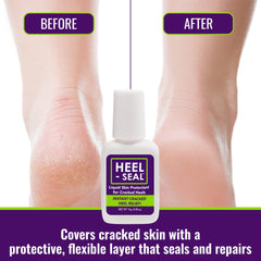 Heel-Seal tampon-preparation pour enlever les peaux mortes.