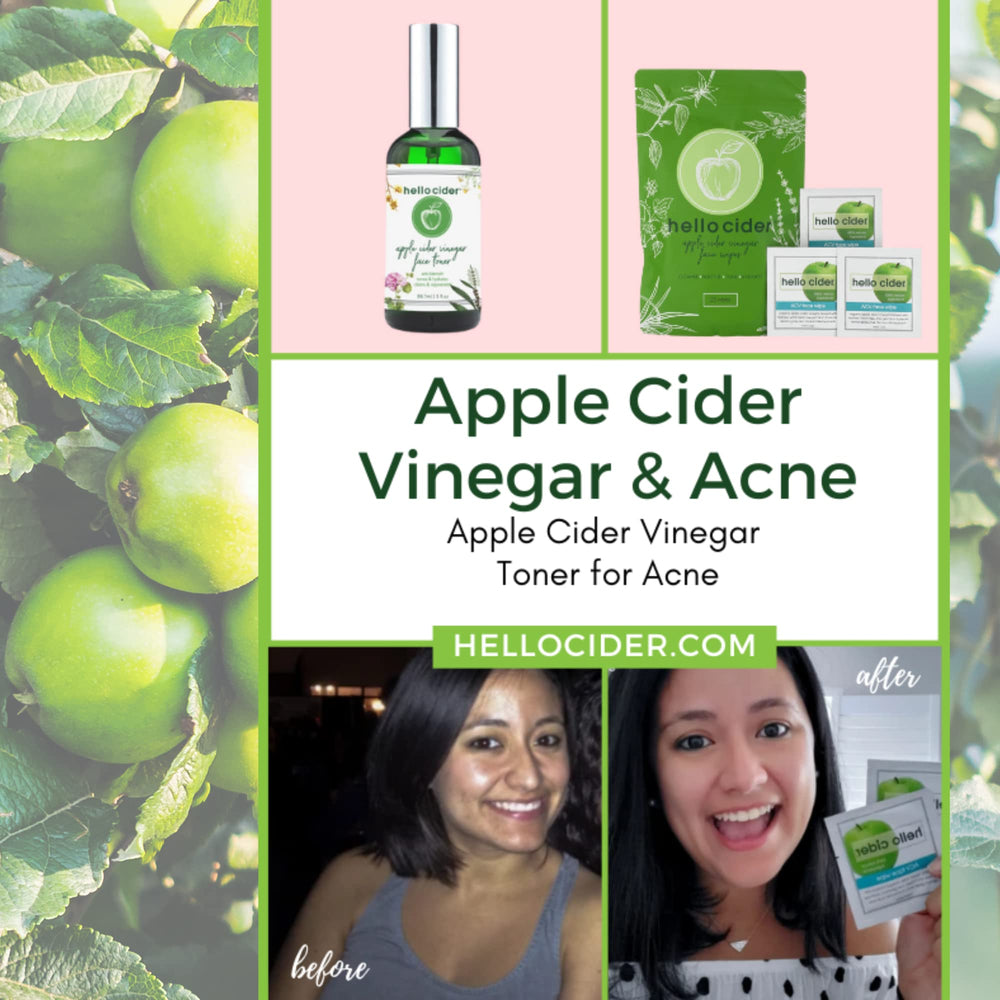 Hello Cider before and after skin comparison showing clearer-looking benefit
