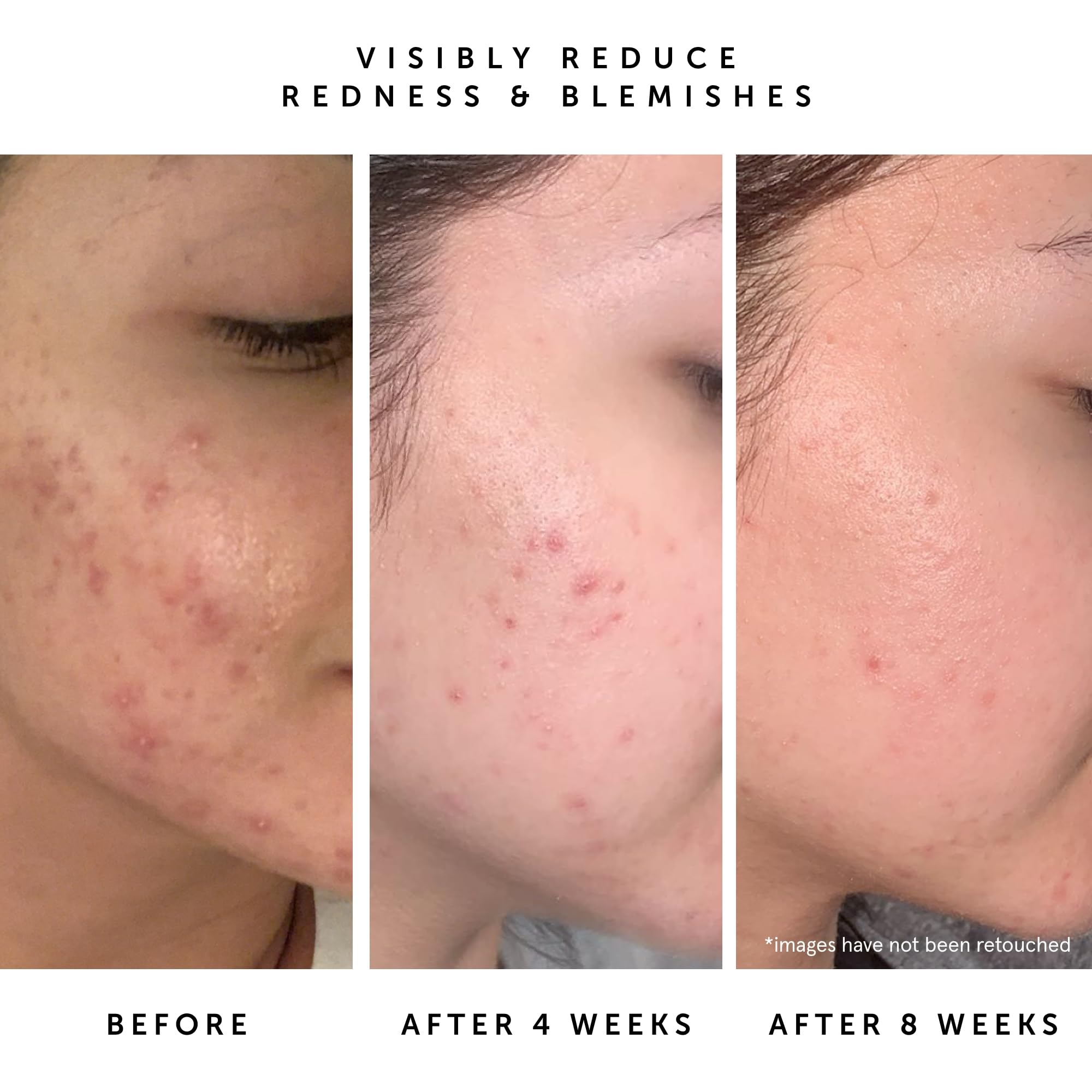 HERBIVORE Lapis Huile Visage: squalane végétal pour retenir l’hydratation durable.