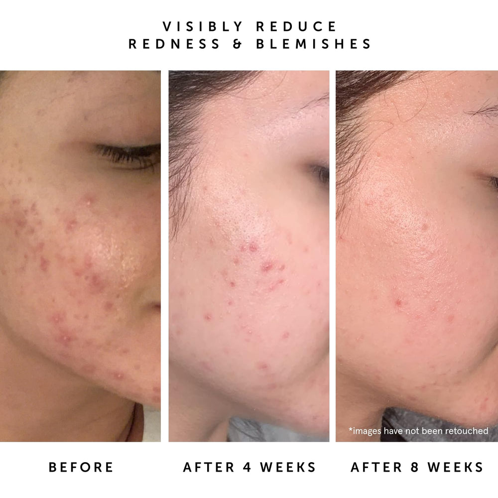 HERBIVORE Lapis Huile Visage: squalane végétal pour retenir l’hydratation durable.