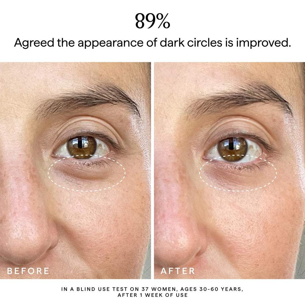 Ingrédients clés vitamine C 5% et curcuma pour l’éclat du regard.