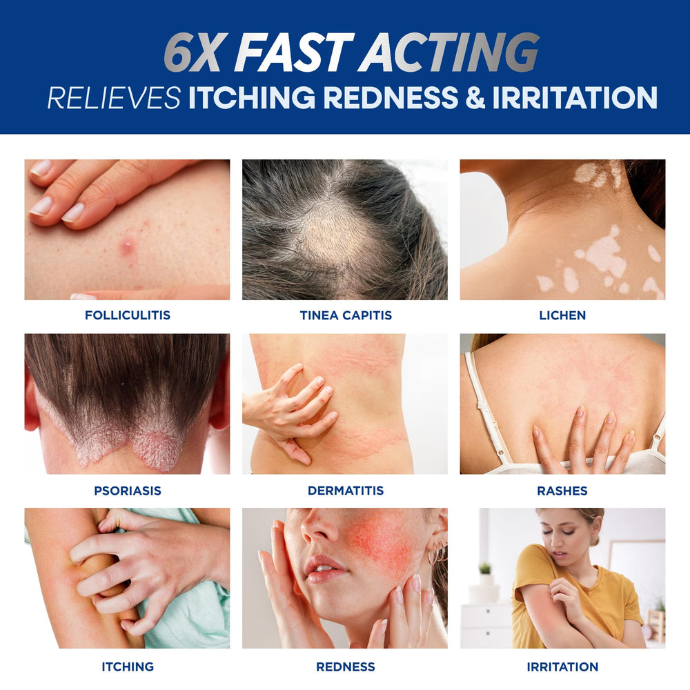 Application sur le cuir chevelu avec Hermon Folliculite, absorption rapide