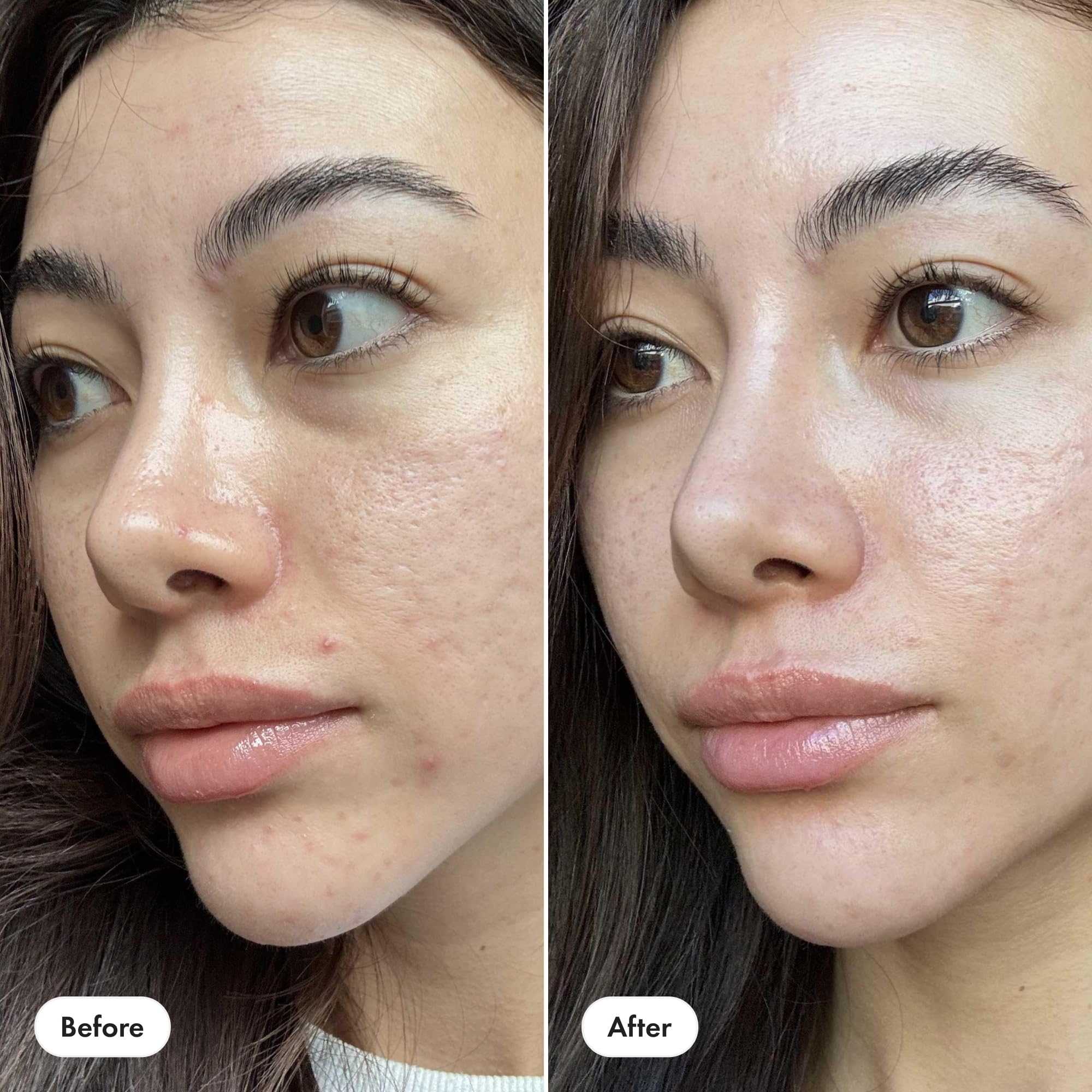 Testé dermatologiquement pour plus de confiance avec Hero Cosmetics.