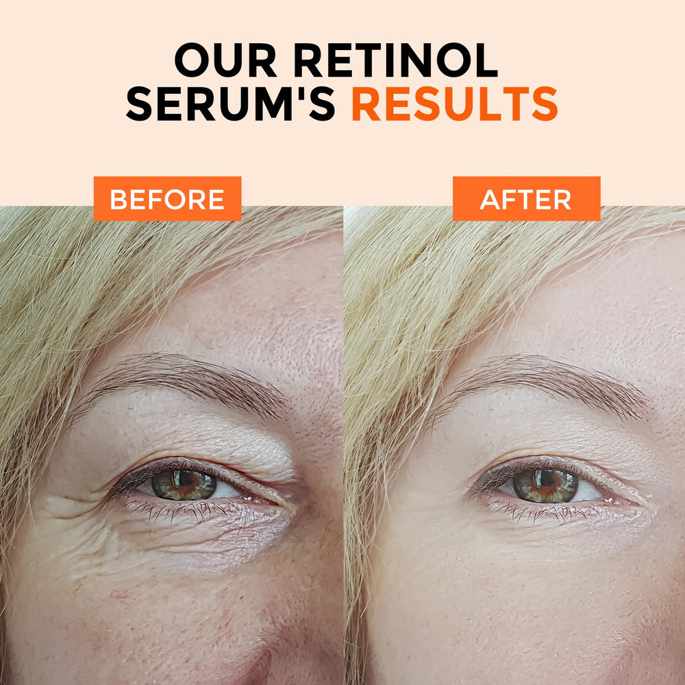 +1HEROLABS Retinol : Ingrédients clés et soin anti‑âge