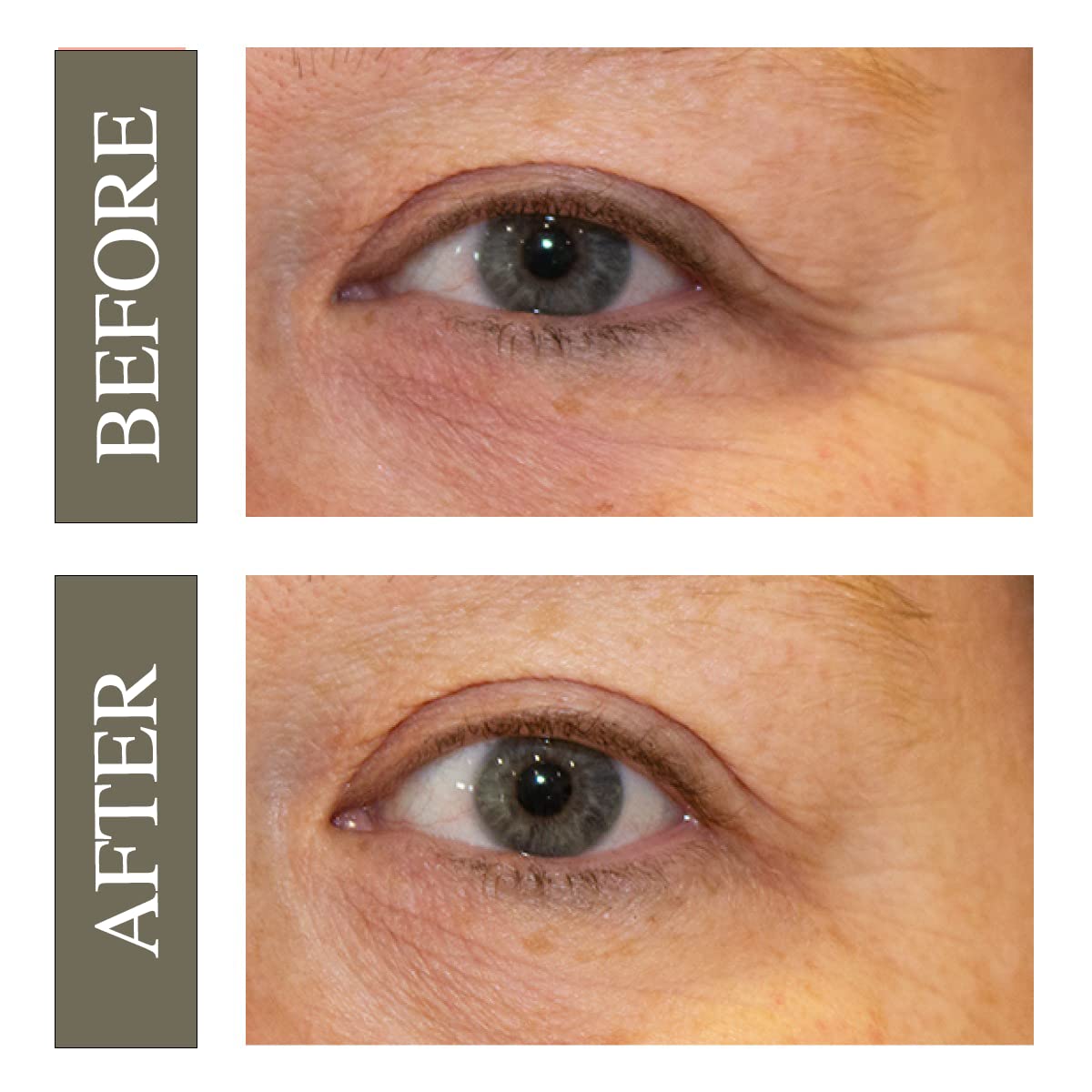 Hey Honey poches et cernes ciblées autour des yeux, effet rafraîchissant