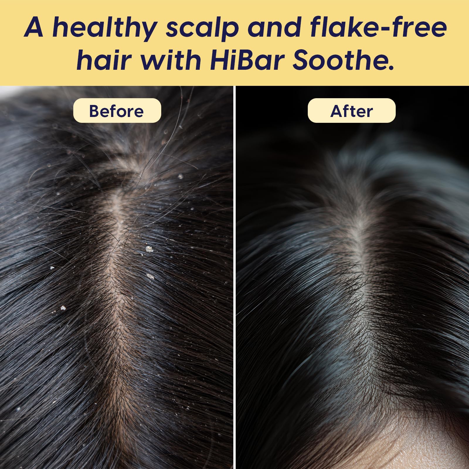 HIBAR Soothe bar in use, massaging scalp for cleansing and hydration